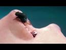 הנתיחה של האלמונית (ש.ל.ר) - טריילר